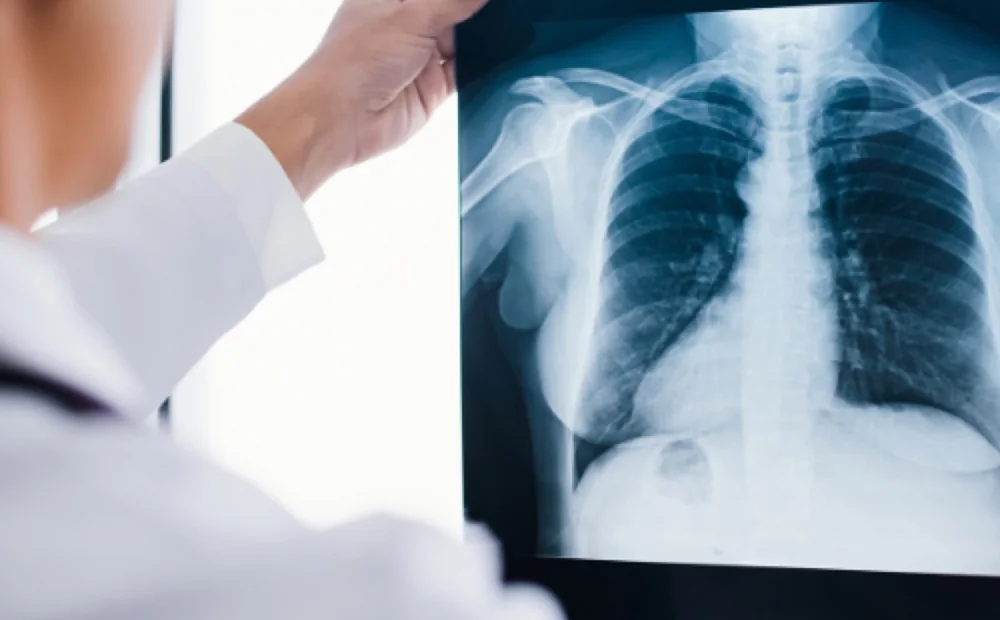 A clinician holding a chest X-ray up to the light