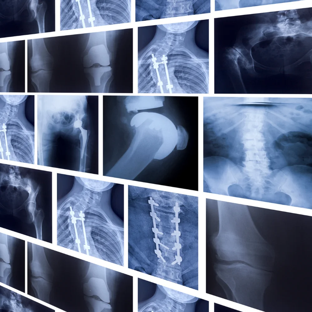 A set of X-ray images of the shoulder, spine and hip